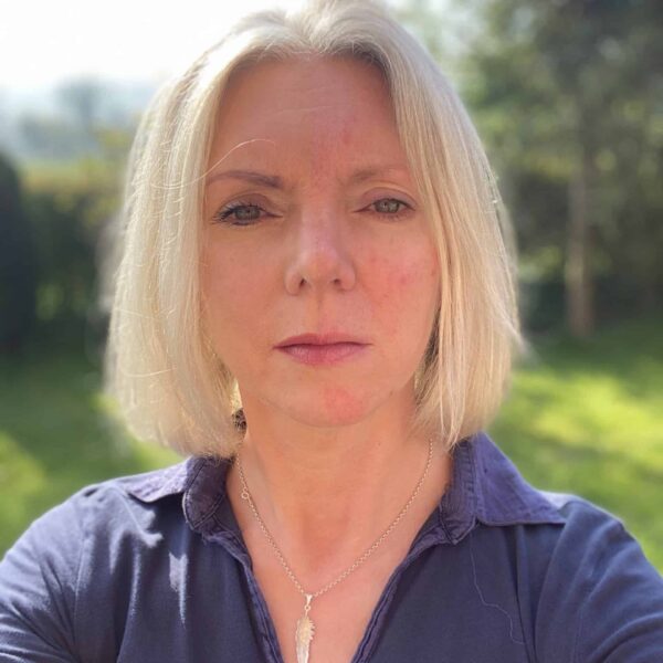 My Rosacea Skincare Routine - for rosacea awareness month