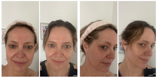 Red Light Therapy for Wrinkles: Before and After Results You Need to See