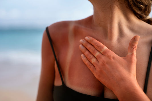 Red Light Therapy for Sun-Damaged Skin: What Actually Helps