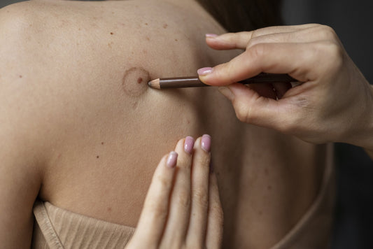 Skin Cancer Statistics: What the Numbers Actually Show