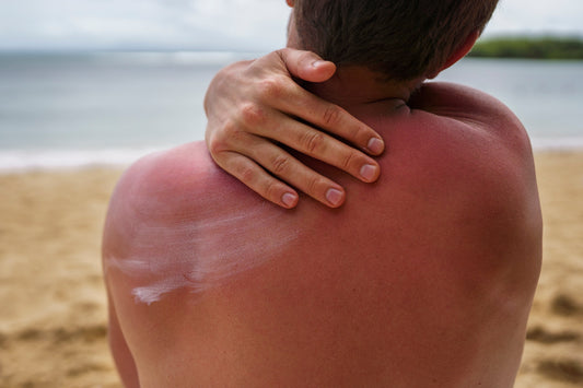 Best Way to Protect Skin From Sun Damage