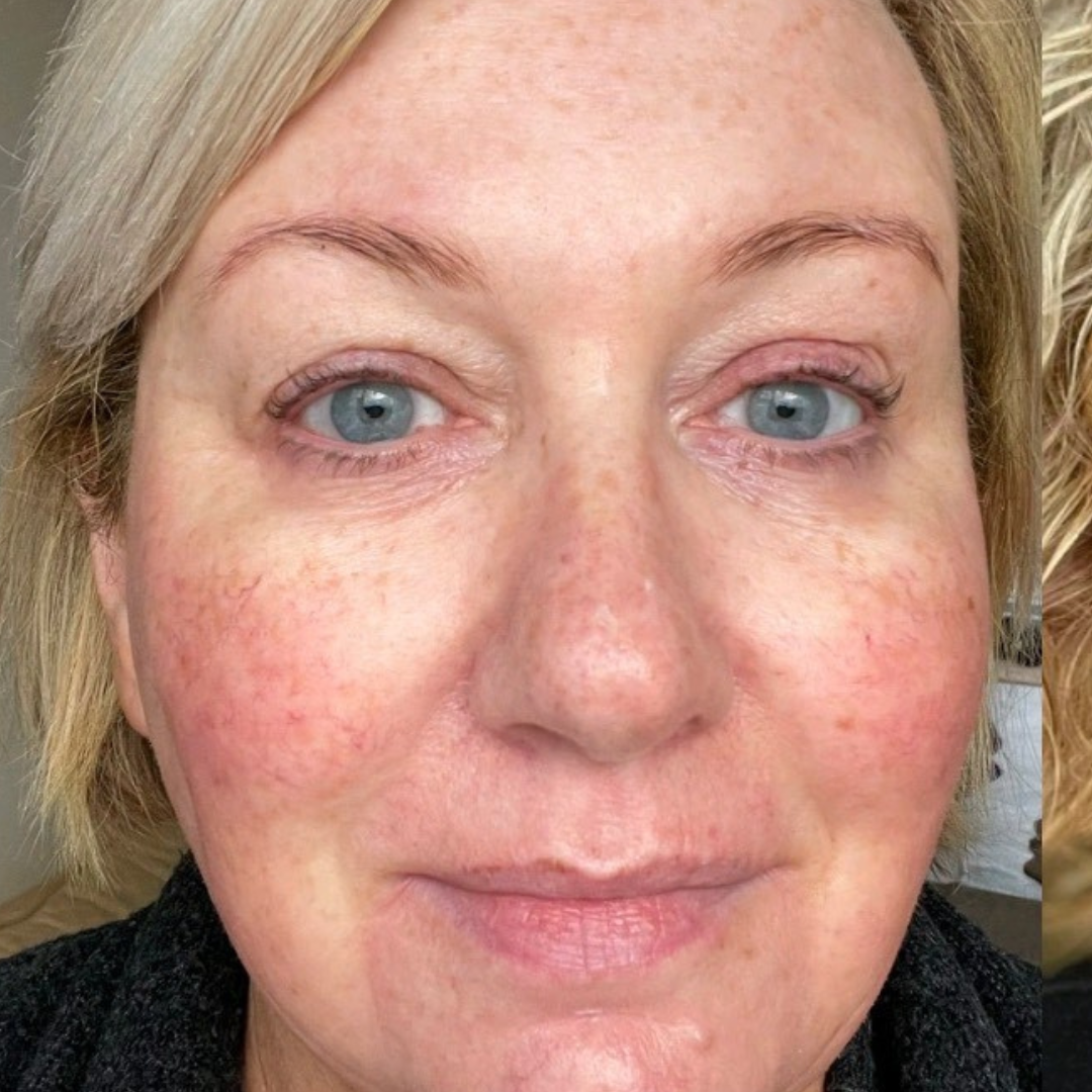 After